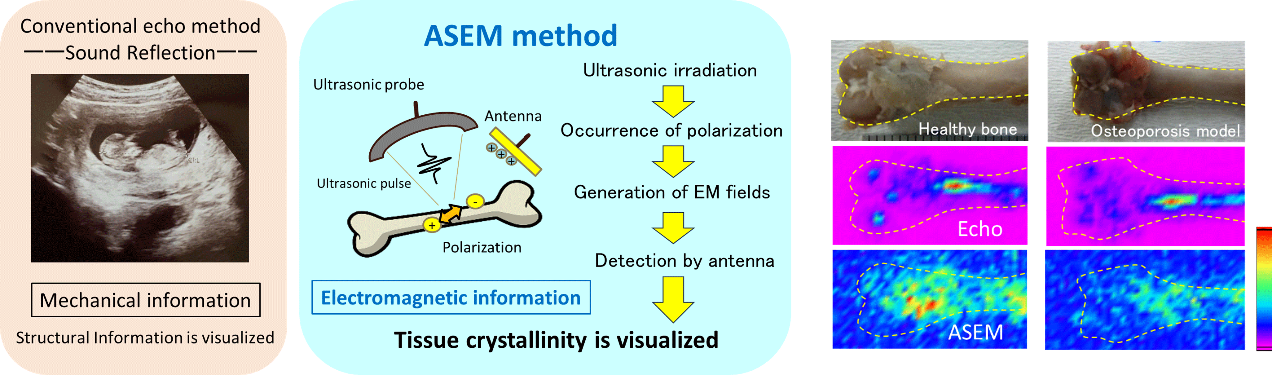 ASEMtech