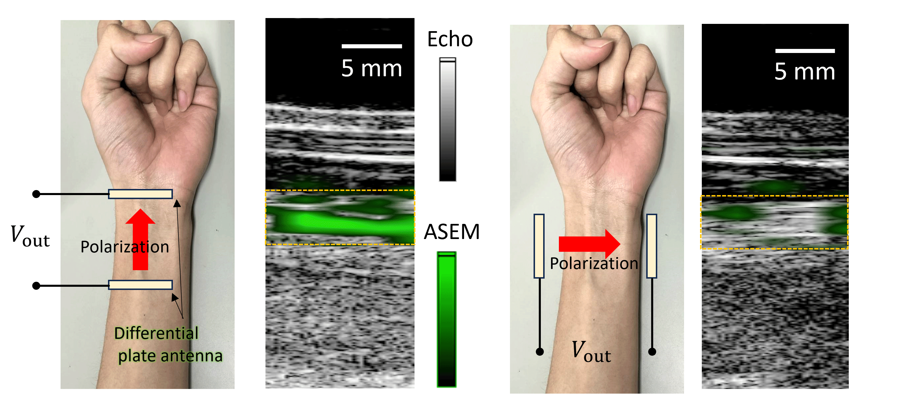 ASEMtech